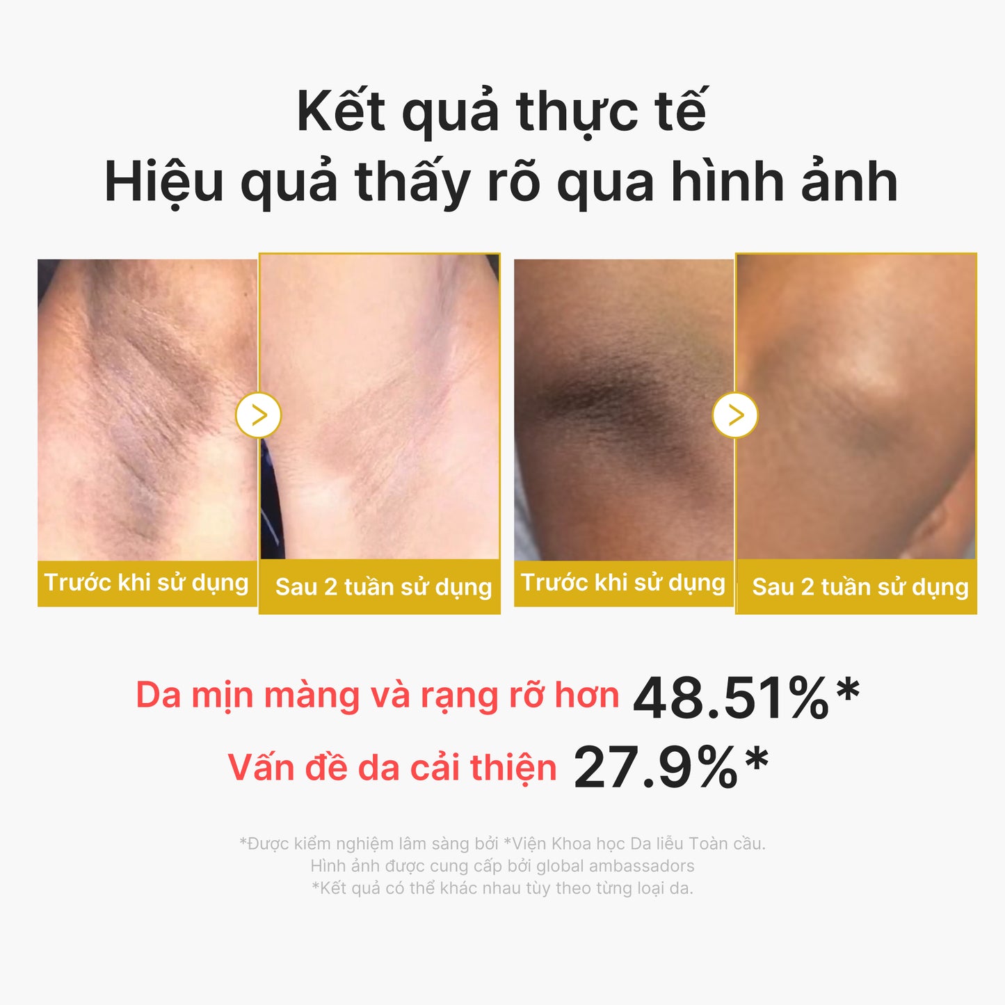 Kojic Acid Turmeric Body Peel Shot