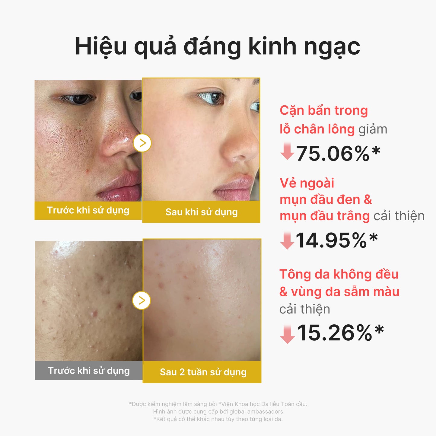 Kojic Acid Turmeric Peel Shot