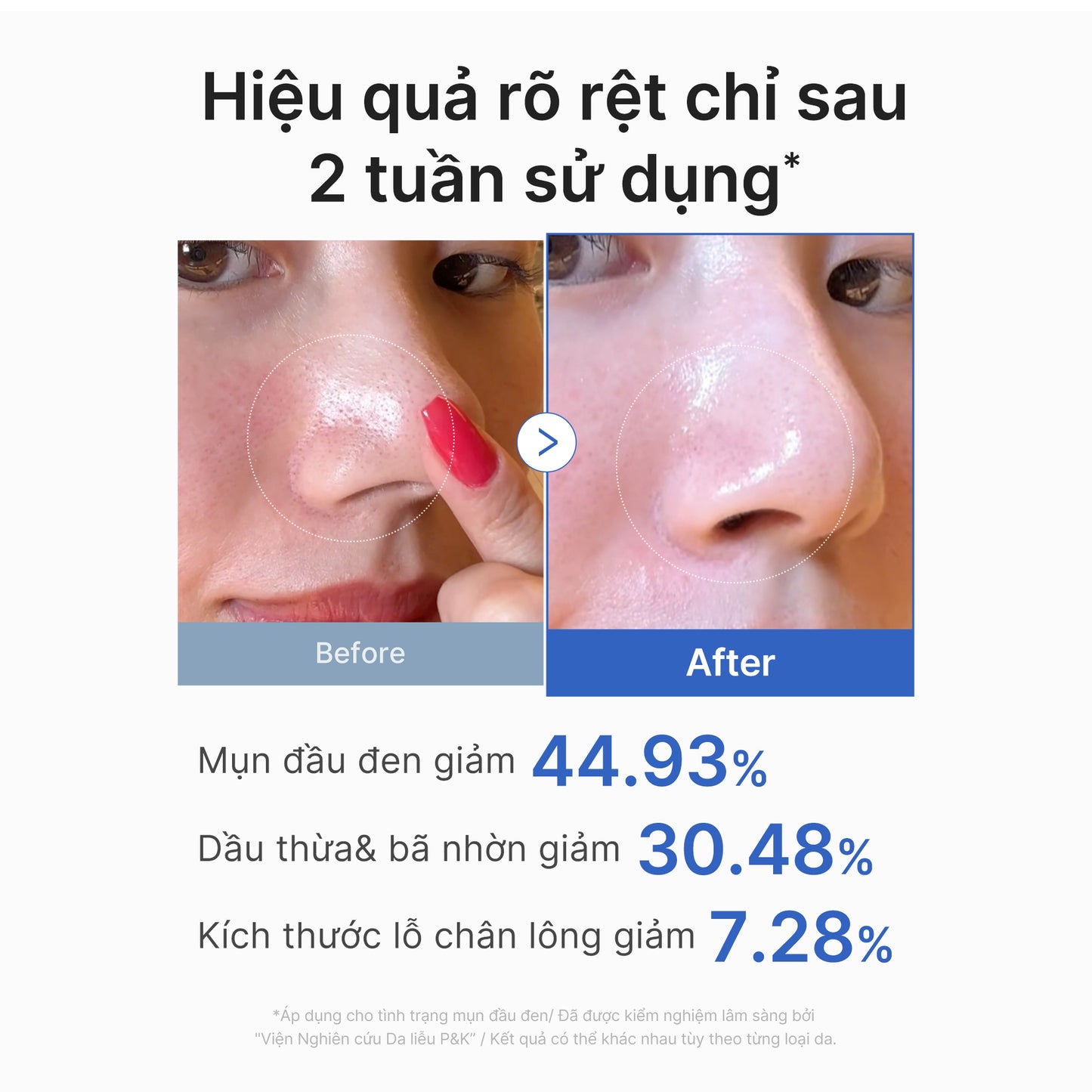 Zero Pore Pads