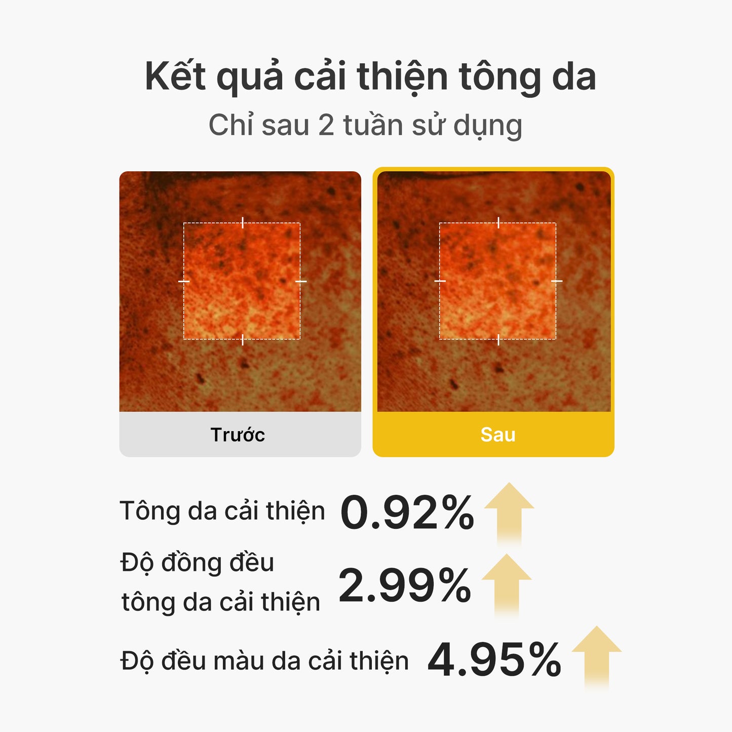 Kojic Acid Turmeric Vita Capsule Cream