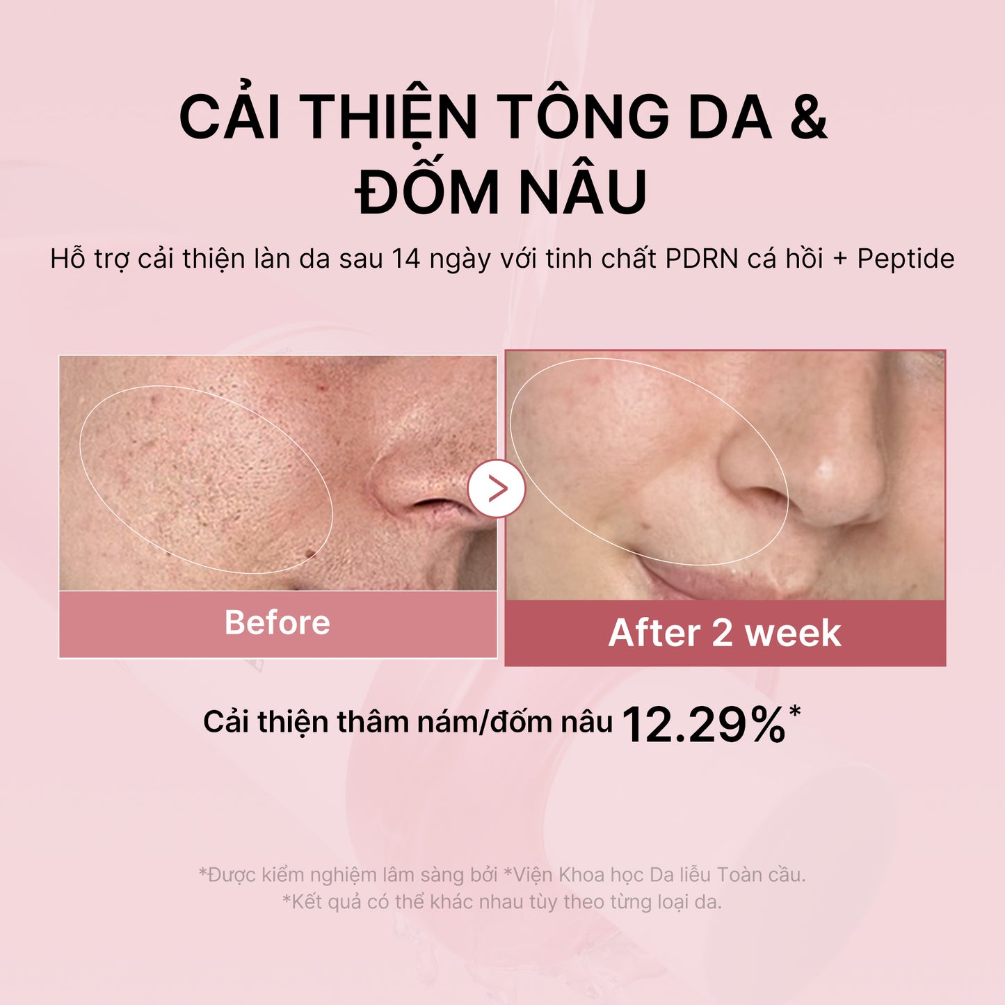 PDRN Pink Peptide Toner